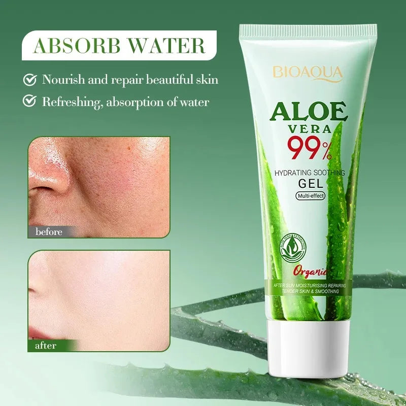 Gel de Aloe Vera Puro: Hidratação Intensiva, Reparação Pós-Sol e Cuidado Anti-Acne – Suavidade e Frescor para Rosto e Corpo